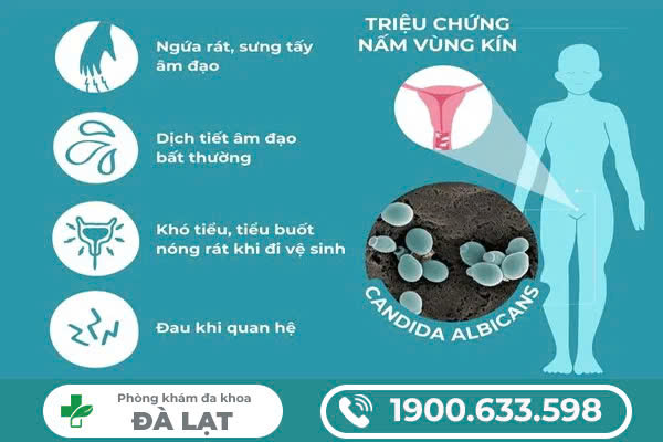 Hình ảnh minh họa